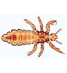 Insectă (insecta) - spaniolă