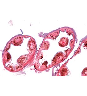 Seria II. Metabolism - diapozitive germane