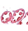 Seria II. Metabolism - diapozitive germane