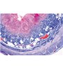 Seria II. Metabolism - diapozitive germane