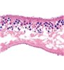 Lemnul, Censequences of Poluation - Diapozitive englezești