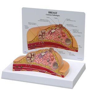 Model de secțiune transversală a sânului