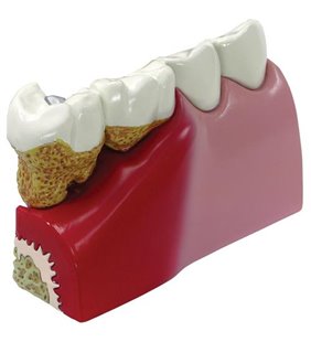 Modelul dinților