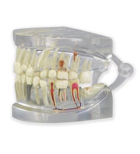 Clear maxilar uman cu modelul dinților