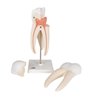 Model de dinți umani molari cu triplă triplu, 3 părți 