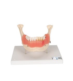 Model de boli dentare, mărit de 2 ori, 21 de părți 