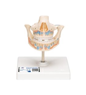 Model de proteză cu lapte cu dinți rămași 