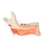 Model complet al maxilarului inferior (jumătatea stângă) cu dinți bolnavi, nervi, vase și glande, 19 părți 