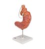 Model de stomac uman cu bandă gastrică, 2 părți 