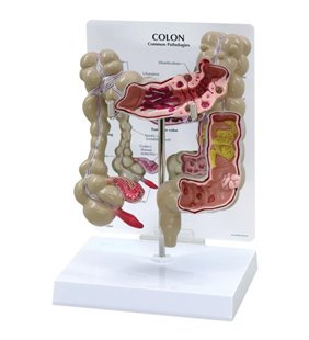 Model de colon