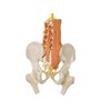 Model pelvic cu mușchii coloanei vertebrale lombare și capete de femur