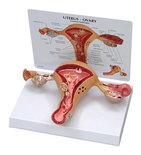 Model de uterovar