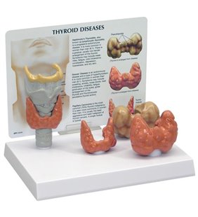 Model tiroidian