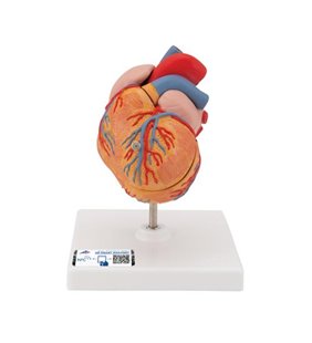 Model clasic al inimii umane cu hipertrofie ventriculară stângă (LVH), 2 parte 