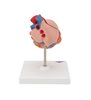 Model clasic al inimii umane cu hipertrofie ventriculară stângă (LVH), 2 parte 
