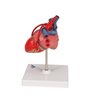 Model clasic de inimă umană cu bypass, 2 părți 