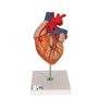 Model de inimă umană cu bypass, de 2 ori - dimensiune naturala, 4 parte 