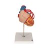 Model de inimă umană cu bypass, de 2 ori - dimensiune naturala, 4 parte 