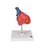 Model clasic de inimă umană, 2 parte 
