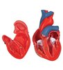 Model clasic de inimă umană, 2 parte 