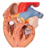 Model de inimă umană cu esofag și trahee, de 2 ori - dimensiune naturala, 5 parte 