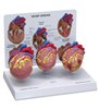 Set de model de inimă de 3 mini