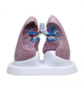 Set pulmonar cu patologii