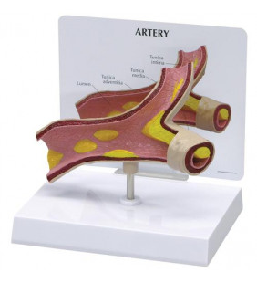 Model de arteră