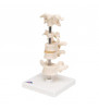 Model de 6 vertebre umane, montat pe stand (Atlas, axă, cervical, 2x toracic, lombar) 