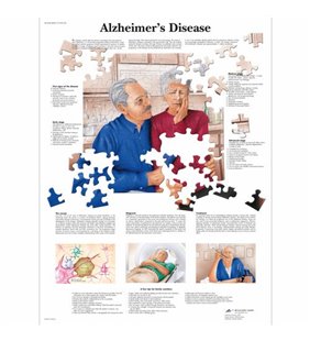 Graficul bolilor Alzheimer