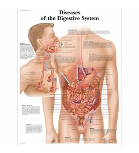 Grafic Boli ale graficului sistemului digestiv