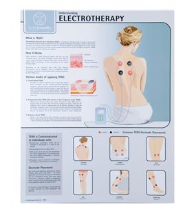 Grafic de electroterapie - laminat