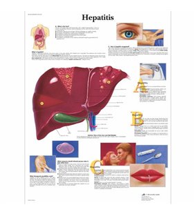 Grafic de hepatită