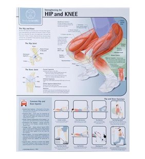 Grafic - Intarirea articulatiei soldului si genunchiului - laminat
