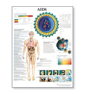 Diagrama SIDA