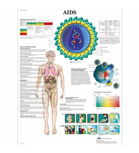 Diagrama SIDA, 50x67 cm, laminat