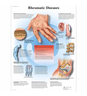 Diagrama bolilor reumatice