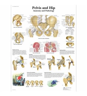 Grafic - Pelvis și șold - anatomie și patologie