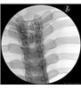 Trainer Injecție spinală toracica - ghidat prin imagini - P66