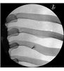 Trainer Injecție spinală toracica - ghidat prin imagini - P66