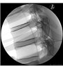 Trainer Injecție spinală toracica - ghidat prin imagini - P66