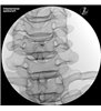 Trainer Injecție spinală cervicala - ghidat prin imagini - P67