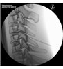 Trainer Injecție spinală cervicala - ghidat prin imagini - P67