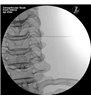 Trainer Injecție spinală cervicala - ghidat prin imagini - P67