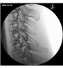 Trainer Injecție spinală cervicala - ghidat prin imagini - P67