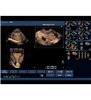 Model de formare cu ultrasunete transvaginale pentru patologie generala Blue Phantom