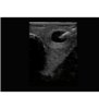 Model de formare cu ultrasunete pentru biopsie tiroidiană Blue Phantom