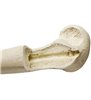 Ulna dreapta ORTHObones Premium