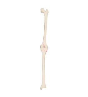 Genunchi drept ORTHObones Premium