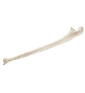 Radius - dreapta - ORTHObones Standard